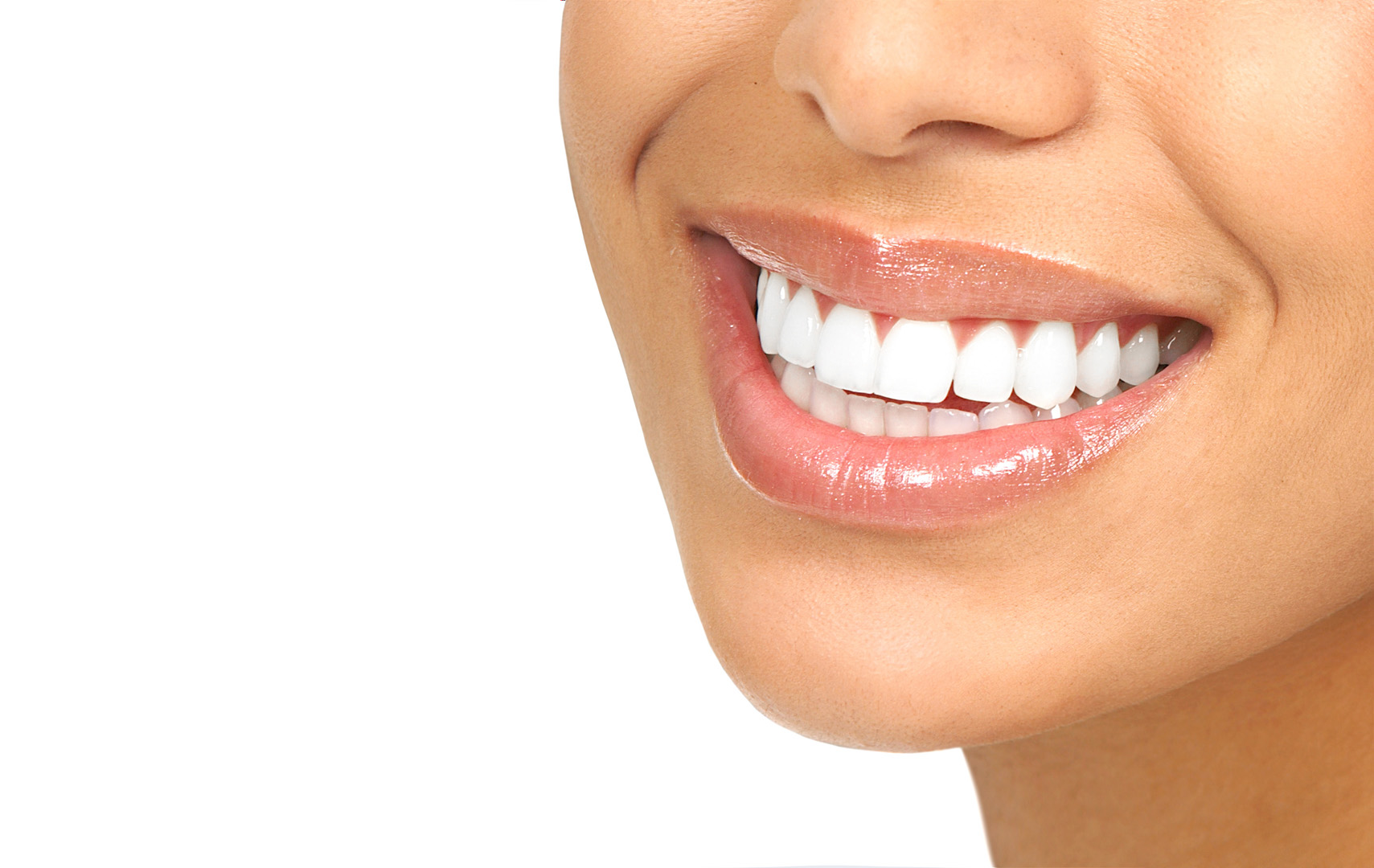 Cosmetic Bonding