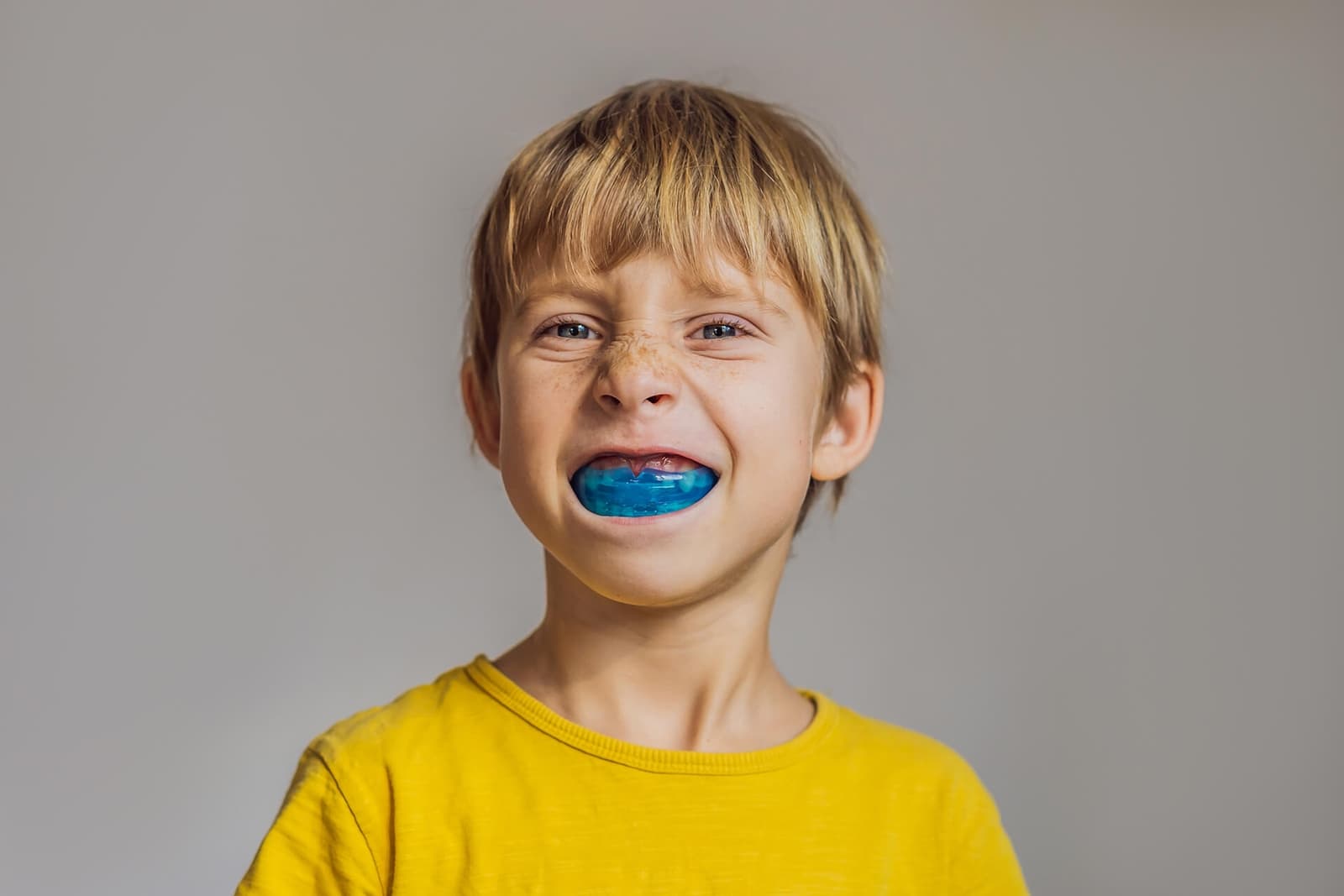 Mouth Guards